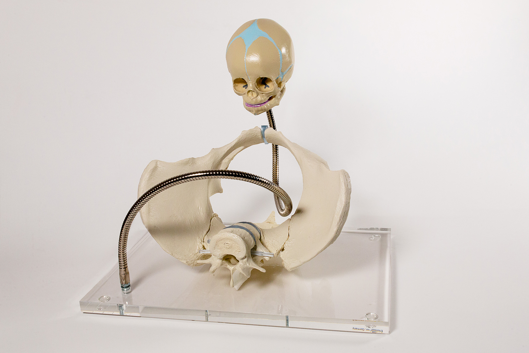 Bäcken, skulptur av Karl & Carl